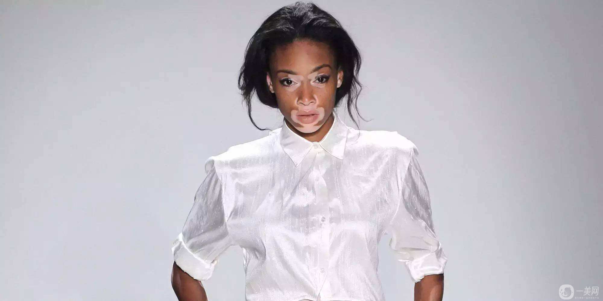 出現(xiàn)白斑該如何處理呢？