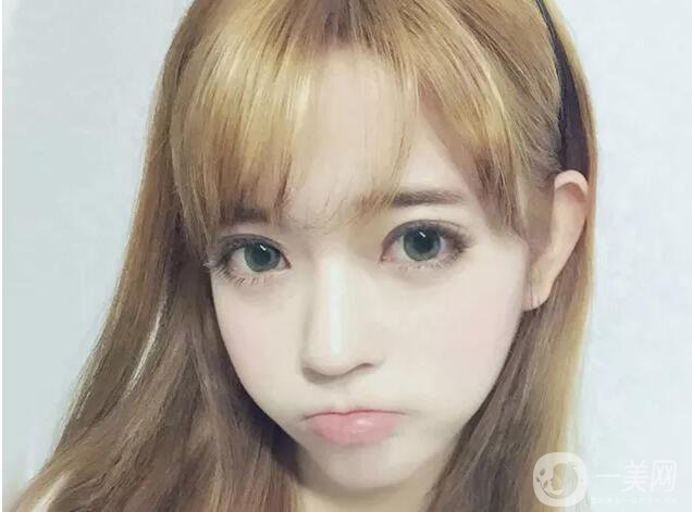 什么眼皮不能割雙眼皮手術(shù) 割雙眼皮注意事項(xiàng)