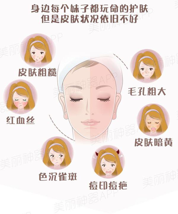 光子嫩膚去痘印*果 光子嫩膚祛痘印原理