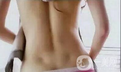 360吸脂減肥靠譜嗎,360吸脂減肥會不會反彈