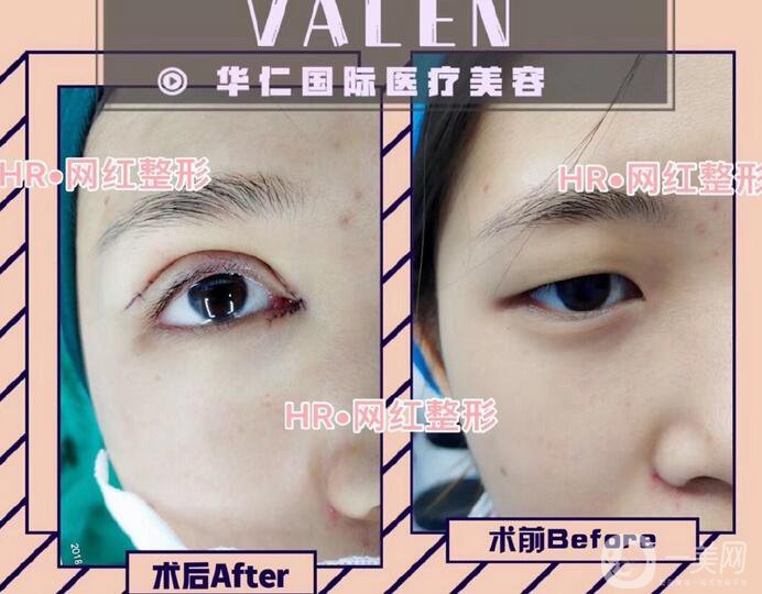 福州華仁整形美容醫(yī)院