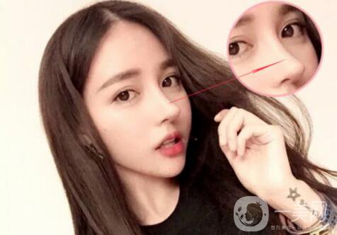 歪鼻矯正手術(shù)是怎樣的 手術(shù)方法有哪些？