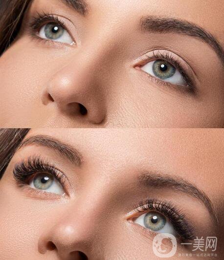 睫毛稀疏成因是什么 該怎么辦?