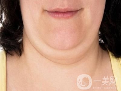 雙下巴怎么形成的 如何去掉雙下巴? 