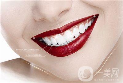 烤瓷牙多少錢一顆 烤瓷牙的種類有哪些