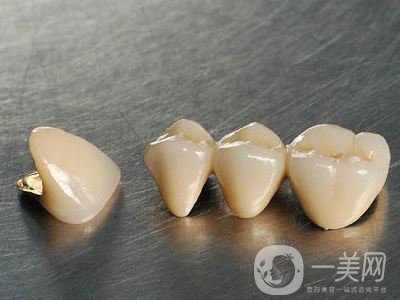 種牙的價格多少 影響種牙價格的原因是什么