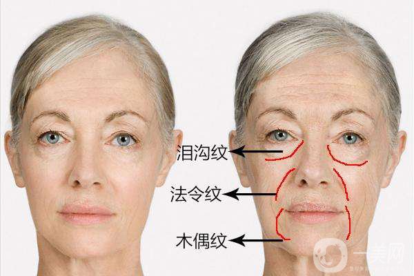 雕塑美學(xué)能治什么 雕塑美學(xué)調(diào)節(jié)時間