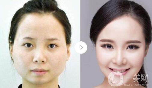 三個(gè)驚人的小竅門 可以使整形手術(shù)恢復(fù)得更快