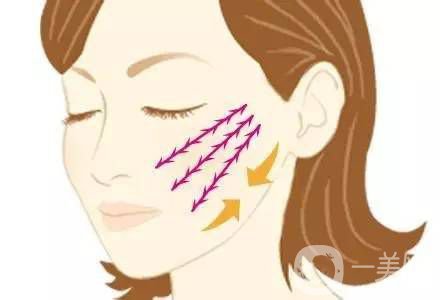 埋線面部提升多久恢復 術(shù)后如何護理？