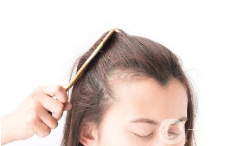 發(fā)際線做了能保持多久時間 發(fā)際線有危害嗎