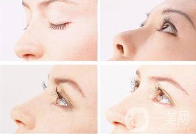 朝天鼻矯正價(jià)格 朝天鼻形成的原因