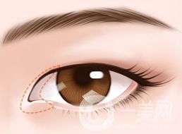 開眼角的*果怎么樣 好不好？