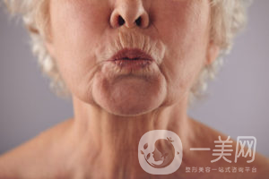 出現(xiàn)煙民線該如何調(diào)節(jié)呢？