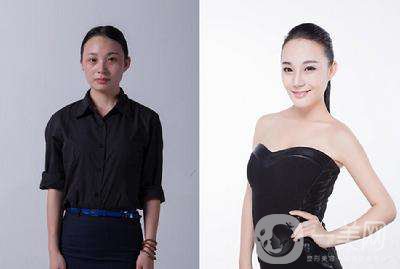 水氧嫩膚的副作用是什么 *果好不好