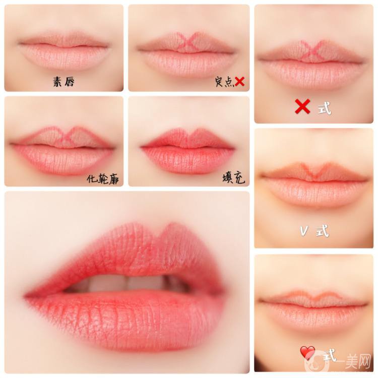 什么是微笑提升手術(shù) 持續(xù)時間是多久