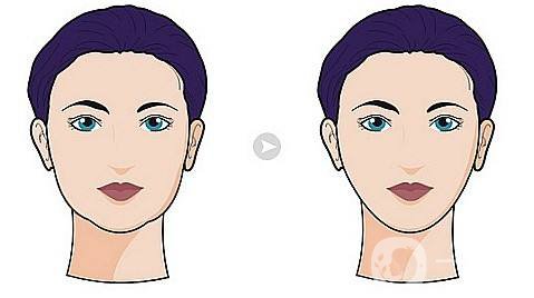 什么是* *手術的特點有哪些