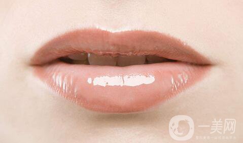 玻尿酸豐唇怎么樣？