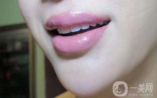 玻尿酸豐唇怎么樣？