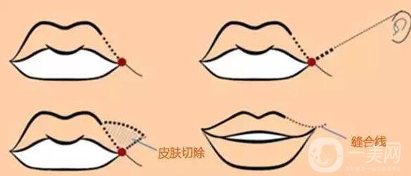 標(biāo)準(zhǔn)的仰月唇女明星有哪些？其中還有AB的整容模板！