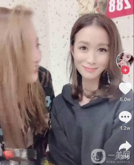 佘詩(shī)曼整容