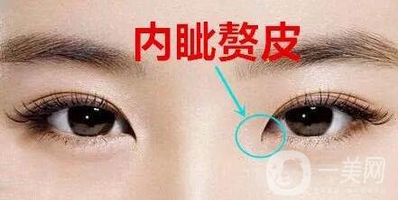 開內(nèi)外眼角的區(qū)別,開內(nèi)眼角,開外眼角