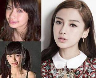 有沒有可能Angelababy不做整容手術就改變了這么多？