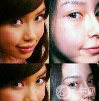 有沒有可能Angelababy不做整容手術就改變了這么多？