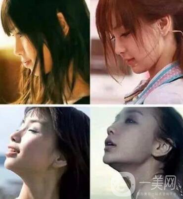 有沒有可能Angelababy不做整容手術就改變了這么多？