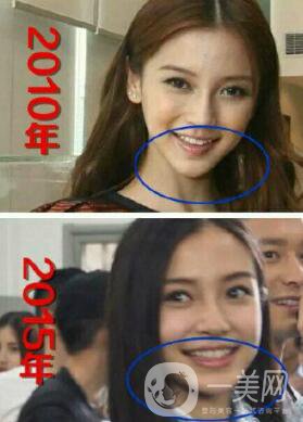 有沒有可能Angelababy不做整容手術就改變了這么多？