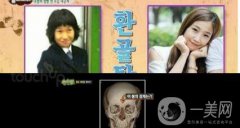 樸智英整形CT掃描曝光 我們可以從中學(xué)到什么？