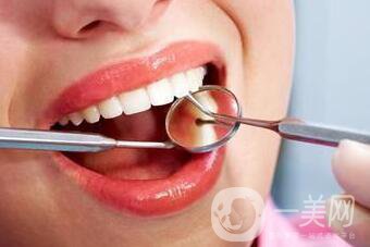 上海洗牙多少錢