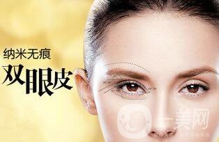 埋線雙眼皮維持幾年,納米*雙眼皮