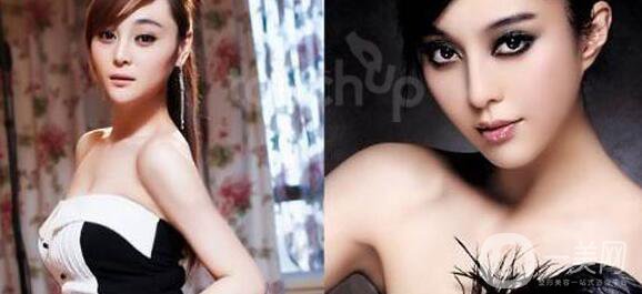 整形手術(shù)是一項(xiàng)不可能完全把你復(fù)制稱為別人的手術(shù)，因?yàn)槟銈兪莾蓚€(gè)有著完全不同的身體。影響外表的因素有很多，包括體型、皮膚狀況、總體健康和骨骼結(jié)構(gòu)。此外，整容手術(shù)完成后的愈合*果也會(huì)因人而異，這也是為什么你永遠(yuǎn)無(wú)法得到和別人一樣的結(jié)果的另一個(gè)原因。根據(jù)這些信息，一定要記住，你應(yīng)該嘗試以一種*適合你的體型的方式來(lái)整形。如果你把你的理想手術(shù)描述為‘我想看起來(lái)像這個(gè)人，你的外科醫(yī)生可能會(huì)提前警告你這是不現(xiàn)實(shí)的。