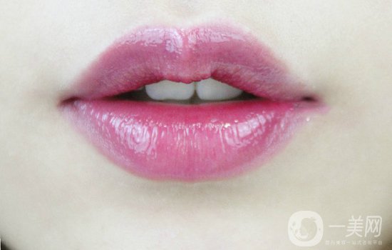 玻尿酸豐唇后會腫嗎？玻尿酸豐唇注意事項