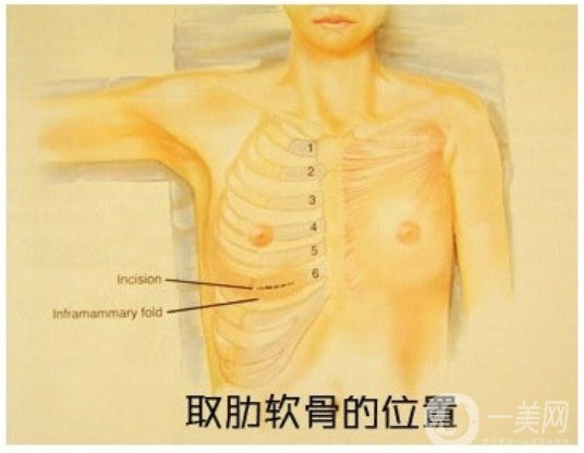 自體肋軟骨隆鼻危害有哪些？隆鼻價(jià)格