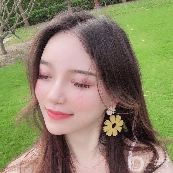 植發(fā)半年后案例 植發(fā)怎么樣？