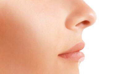 鼻翼縮小圖 鼻翼縮小有什么后遺癥嗎？
