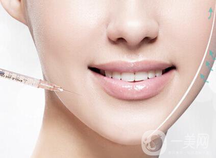 進(jìn)口**多錢