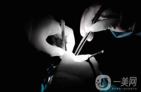 軟骨隆鼻能保持多久？軟骨隆鼻怎么樣？