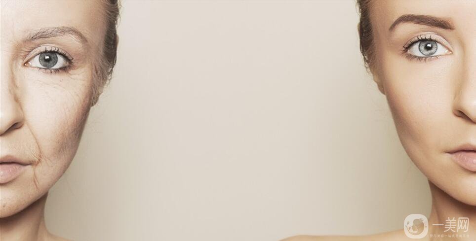 如何*祛皺 去皺的方法介紹