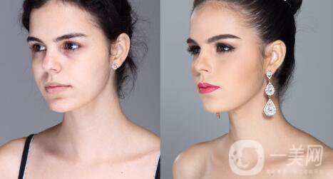 整容手術(shù)：事先要知道什么？