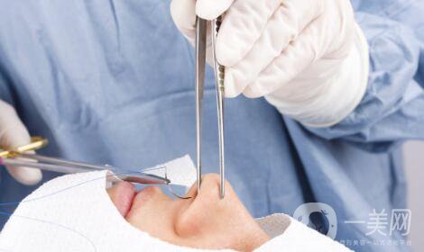 隆鼻手術有什么*果？它的風險有哪些？