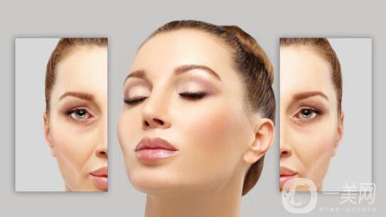 臉部哪里容易長皺紋？臉上皺紋怎么去除