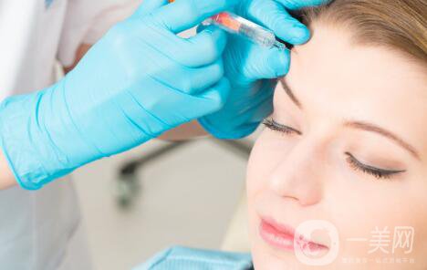 臉部哪里容易長皺紋？臉上皺紋怎么去除