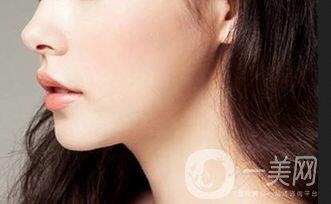 墊下巴后遺癥,假體墊下巴