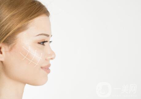 伊婉玻尿酸多少錢一支？玻尿酸每個部位用量