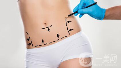 環(huán)形吸脂減肥是什么？吸脂后皮膚會(huì)不會(huì)松弛？