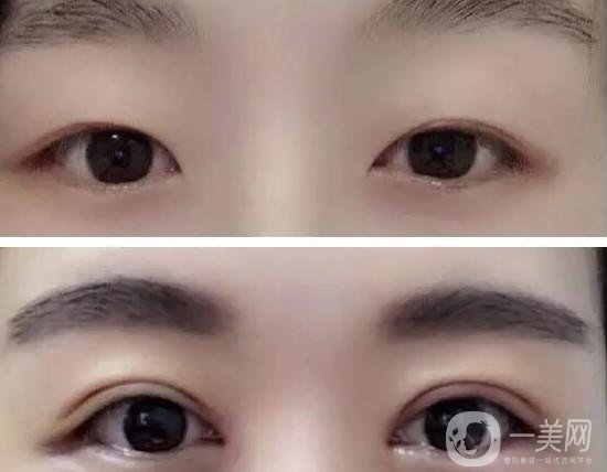 楊曉楠：整形外科界大咖 讓你的眼睛會(huì)說(shuō)話