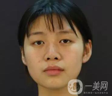 石家莊整形美容信息介紹？美聯(lián)臣整形怎樣？美聯(lián)臣價(jià)格