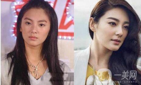 成都眼部整形專題 明星眼部整形